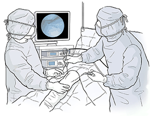 Two healthcare providers performing knee arthroscopy on patient in operating room.