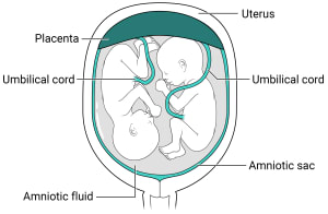 Within the uterus, there is one placenta with an amniotic sac, amniotic fluid, and two fetuses inside.