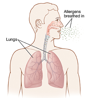 Front view of man's head and chest showing allergens being breathed into lungs.