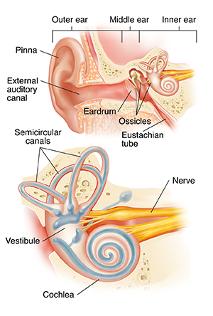 Cross section of ear showing outer, middle, and inner ear with closeup of cochlea.