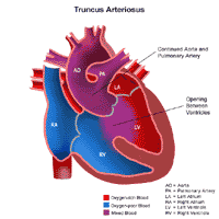 Anatomy of a heart with truncus arteriosus