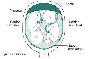 Dentro del útero, hay una placenta con un saco amniótico, líquido amniótico y dos fetos en su interior.